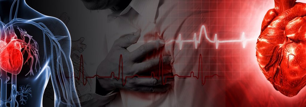 Ишемическая болезнь сердца и сердечный приступ