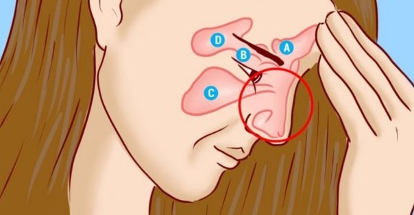 Избавься от инфекции носовых пазух всего за 5 минут! Знать бы этот метод раньше…