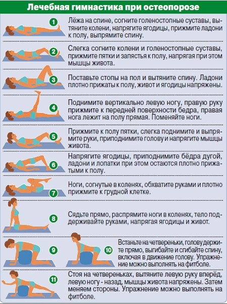 Эффективный комплекс физических упражнений при остеопорозе