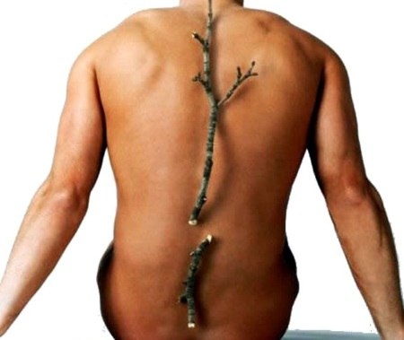 Причины, лечение и профилактика остеопороза у мужчин