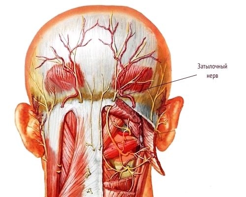 Невралгия затылочного нерва: симптомы и лечение