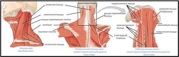 Воспаление шейных мышц