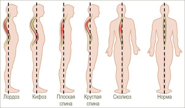 Следим за осанкой