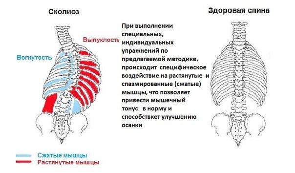 Малоподвижный образ жизни.Мышечный дисбаланс.