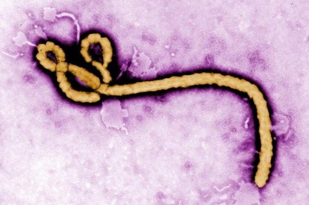 Лихорадка Эбола: что нужно знать