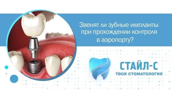 Звенят ли зубные импланты при прохождении контроля в аэропорту? Некоторые считают, что если импланты сделаны из металла, то металлоискатель обязательно отреагирует, а охрана задержит их, как опасных преступников. Звенят ли зубные импланты при прохождении контроля в аэропорту? Некоторые считают, что если импланты сделаны из металла, то металлоискатель обязательно отреагирует, а охрана задержит их, как опасных преступников.