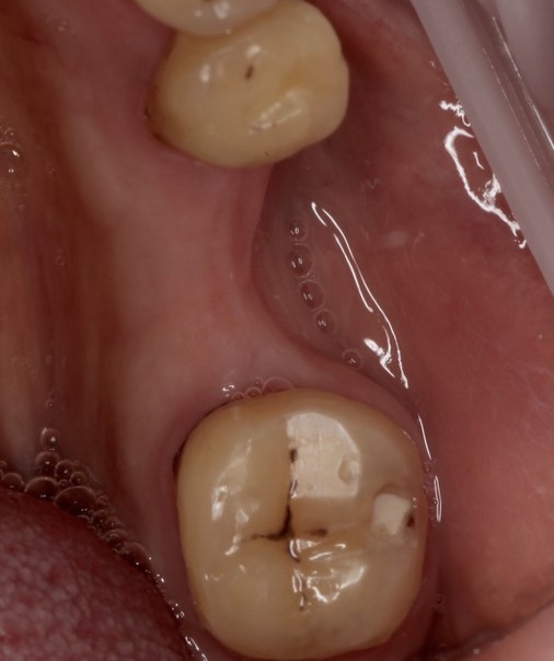 Современные технологии меняют представление о стоматологии!