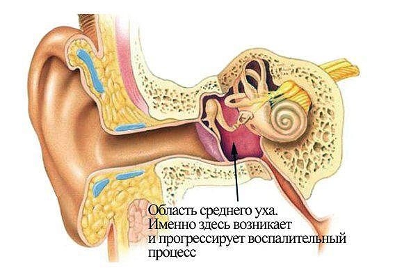 Отит - это воспалительный процесс слухового прохода. При нем возникает резкая боль, особенно при потягивании за мочку уха. Возможно снижение слуха, высокая температура. Отит - это воспалительный процесс слухового прохода. При нем возникает резкая боль, особенно при потягивании за мочку уха. Возможно снижение слуха, высокая температура.
