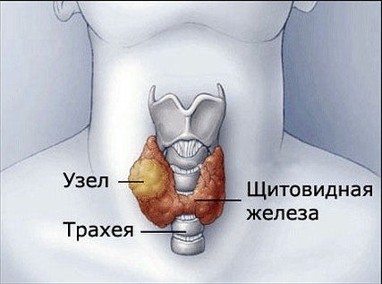 Как привести в порядок щитовидку? Смотрите рецепт под фото и ставьте "Класс!", чтобы сохранить его на своей страничке. Как привести в порядок щитовидку? Смотрите рецепт под фото и ставьте "Класс!", чтобы сохранить его на своей страничке.