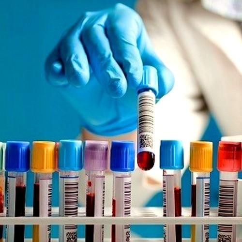 Анализы на гормоны в репродуктологии Анализы на гормоны в репродуктологии
